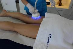 Masaj endermologic Selenia Xmagic anticelulitic, drenaj limfatic